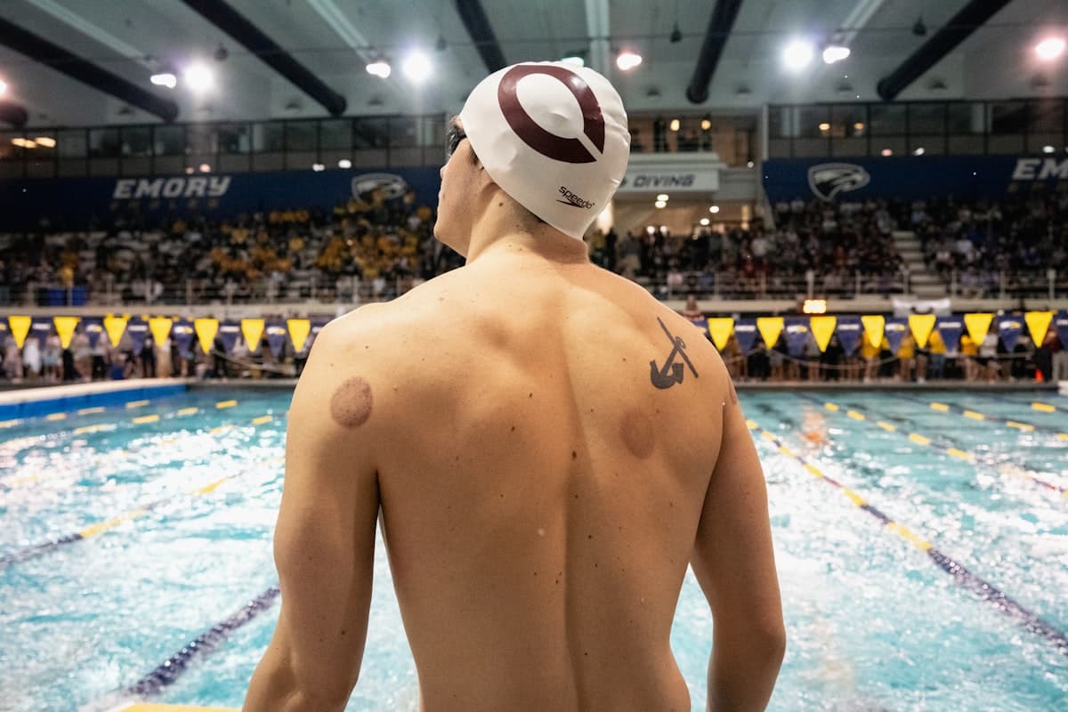 Round cupping marks visible on an athlete's back at a pool