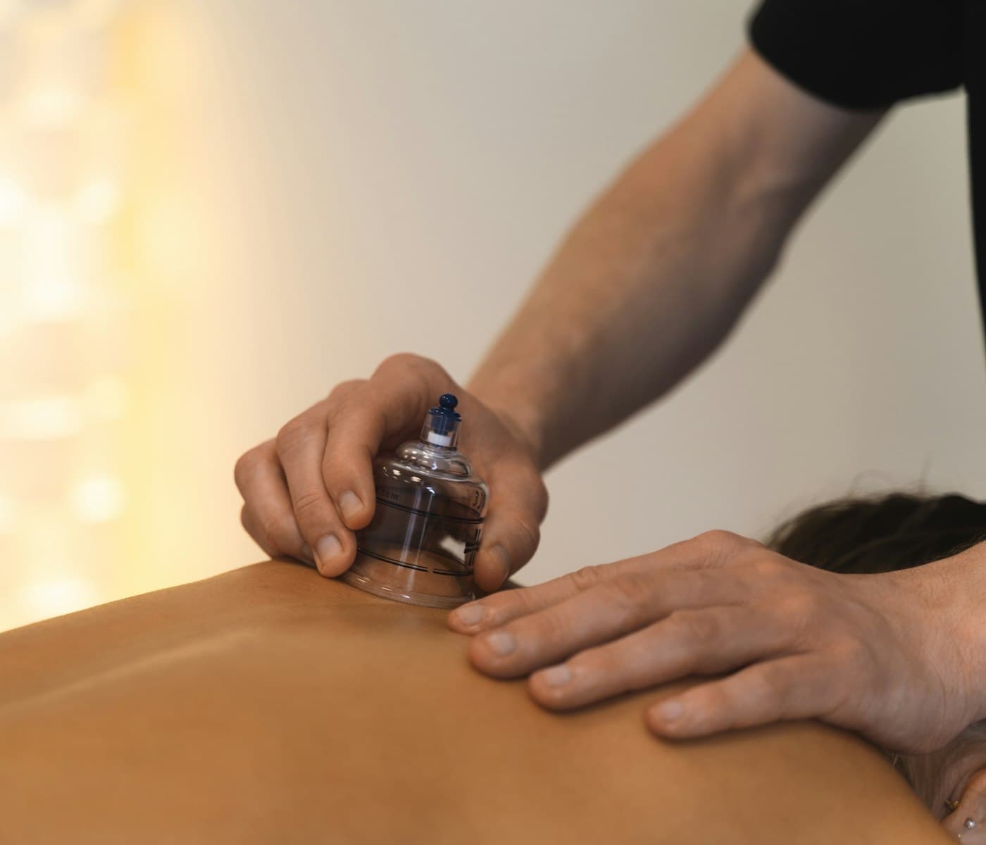 A therapist placing a suction cup on a client's back